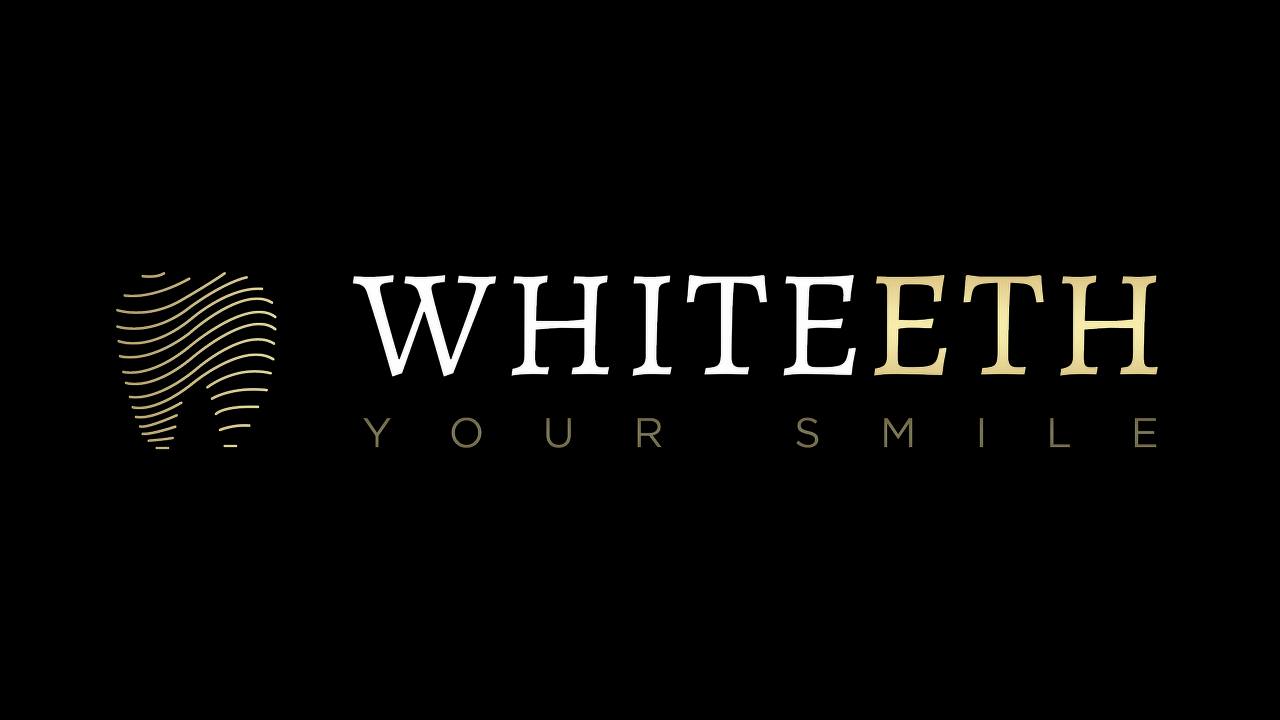 Косметическое отбеливание зубов от 49 р. в студии "Whiteeth 2.0"